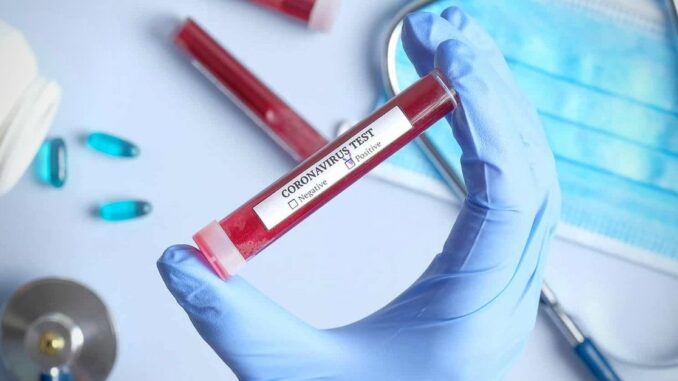 coronavirus