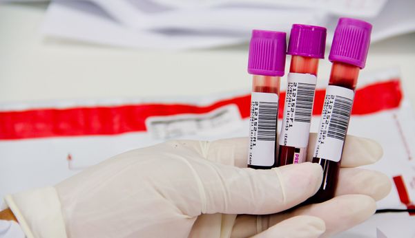exame de sangue